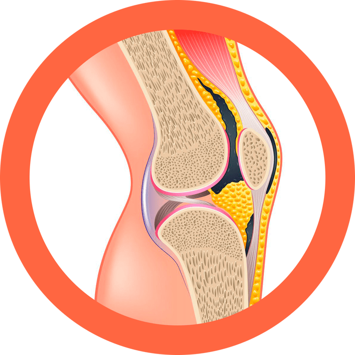 Hondroten - obnovuje klouby a svaly