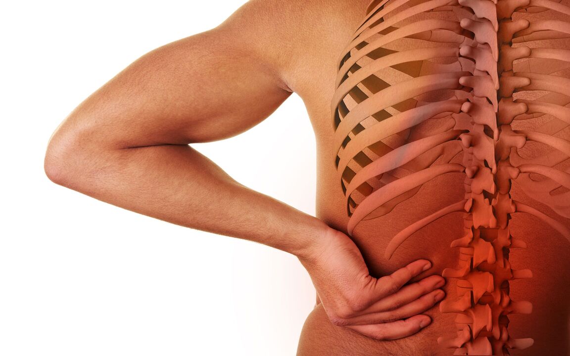 příznaky bederní osteochondrózy